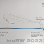 Ureterstent (JJ-splint)